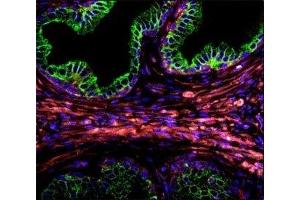 Confocal immunofluorescent analysis of Cytokeratin-18 antibody with prostate carcinoma followed by Alexa Fluor 488-conjugated goat anti-rabbit lgG (green). (Cytokeratin 18 Antikörper  (AA 401-430))