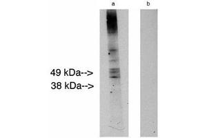 Image no. 1 for anti-Ceramide Synthase 2 (CERS2) antibody (ABIN793690) (Ceramide Synthase 2 Antikörper)