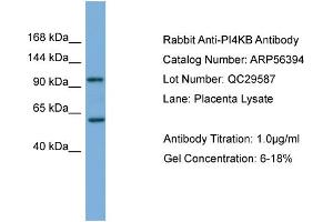 WB Suggested Anti-PI4KB  Antibody Titration: 0. (PI4KB Antikörper  (Middle Region))