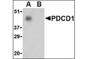 Western blot analysis of PD-1 in THP-1 cell lysate with AP30650PU-N PD1 antibody at 1 μg/ml in the (A) absence and (B) presence of blocking peptide. (PD-1 Antikörper  (C-Term))