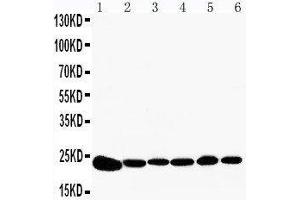 Anti-Peroxiredoxin 2 antibody, Western blotting Lane 1: Rat Brain Tissue Lysate Lane 2: Rat Kidney Tissue Lysate Lane 3: HELA Cell Lysate Lane 4: JURKAT Cell Lysate Lane 5: 293T Cell Lysate Lane 6: A549 Cell Lysate (Peroxiredoxin 2 Antikörper  (C-Term))