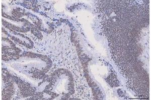 IHC analysis of HnRNP H/HNRNPH1 using anti-HnRNP H/HNRNPH1 antibody (ABIN4886623).