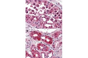 Immunohistochemical (Formalin/PFA-fixed paraffin-embedded sections) staining in human testis (A) and human kidney (B) with NPSR1 polyclonal antibody . (NPSR1 Antikörper  (2nd Extracellular Domain))