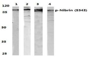 Image no. 1 for anti-Nibrin (NBN) (pSer343) antibody (ABIN318326) (Nibrin Antikörper  (pSer343))