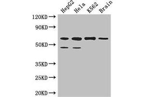 Western Blot Positive WB detected in: HepG2 whole cell lysate, Hela whole cell lysate, K562 whole cell lysate, Mouse brain tissue All lanes: PAF1 antibody at 3. (PAF1/PD2 Antikörper  (AA 1-300))