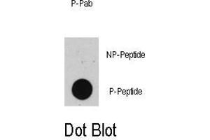Image no. 1 for anti-Tumor Protein P53 (TP53) (pThr55) antibody (ABIN358423)