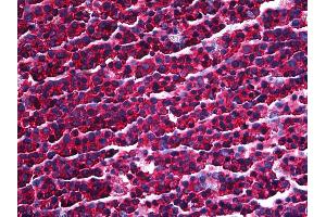 Immunohistochemistry (IHC) image for anti-Protein Kinase, Interferon-Inducible Double Stranded RNA Dependent Activator (PRKRA) (AA 1-314) antibody (ABIN626078)