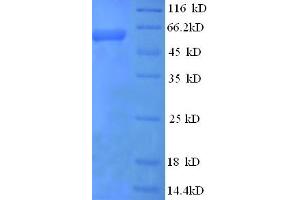 SDS-PAGE (SDS) image for Interleukin 12 beta (IL12B) (AA 23-327) protein (His tag) (ABIN5709731) (IL12B Protein (AA 23-327) (His tag))
