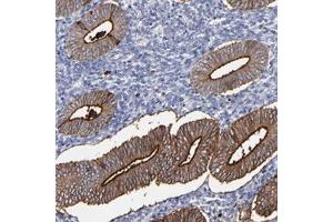 Immunohistochemical staining of human uterine corpus with CPM polyclonal antibody  shows strong membranous and moderate cytoplasmic positivity in glandular cells.