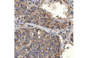 IHC analysis of SLC25A24 using anti-SLC25A24 antibody (ABIN7599228).