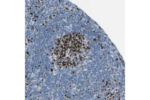 Immunohistochemical staining (Formalin-fixed paraffin-embedded sections) of human lymph node with MCM4 polyclonal antibody  shows strong nuclear positivity in cells in reaction center. (MCM4 Antikörper)