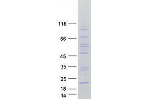 Validation with Western Blot (FAM86C1 Protein (Transcript Variant 2) (Myc-DYKDDDDK Tag))