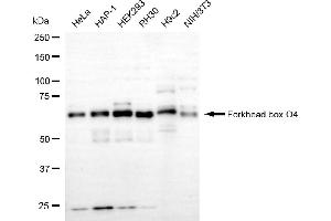 Western blotting analysis using forkhead box O4 antibody (ABIN7798649). (Rekombinanter FOXO4 Antikörper)