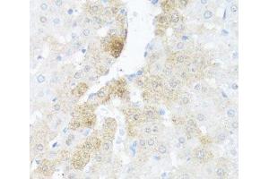 Immunohistochemistry of paraffin-embedded Rat liver using BCL2L2 Polyclonal Antibody at dilution of 1:100 (40x lens). (BCL2L2 Antikörper)