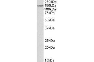 AP22387PU-N LMTK2 antibody staining of Human Cerebellum lysate at 2 µg/ml (35µg protein in RIPA buffer). (LMTK2 Antikörper  (Internal Region))