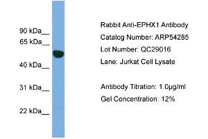 WB Suggested Anti-EPHX1  Antibody Titration: 0. (EPHX1 Antikörper  (N-Term))