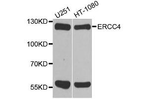 Western blot analysis of extracts of various cell lines, using ERCC4 antibody. (ERCC4 Antikörper  (AA 600-700))