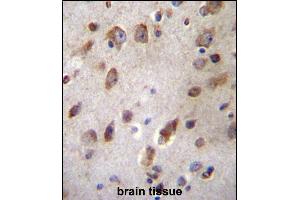 Immunohistochemistry (Paraffin-embedded Sections) (IHC (p)) image for anti-UDP-GlcNAc:betaGal beta-1,3-N-Acetylglucosaminyltransferase 1 (B3GNT1) (AA 366-394), (C-Term) antibody (ABIN657124)
