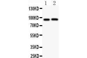 Western Blotting (WB) image for anti-Potassium Voltage-Gated Channel, Shab-Related Subfamily, Member 1 (KCNB1) (AA 687-858) antibody (ABIN3043866)