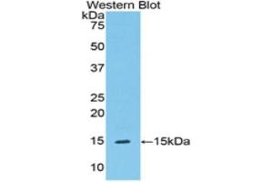 Western Blotting (WB) image for anti-Serpin Peptidase Inhibitor, Clade G (C1 Inhibitor), Member 1 (SERPING1) (AA 211-331) antibody (ABIN1172650) (SERPING1 Antikörper  (AA 211-331))