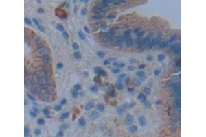 IHC-P analysis of Human Tissue, with DAB staining. (IL17RA Antikörper  (AA 33-172))