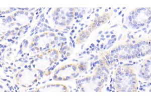 Detection of TNC in Human Stomach Tissue using Polyclonal Antibody to Tenascin C (TNC) (TNC Antikörper  (AA 49-181))