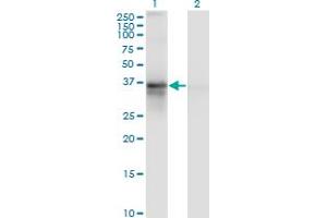 Western Blot analysis of RP2 expression in transfected 293T cell line by RP2 monoclonal antibody (M02), clone 5C10.