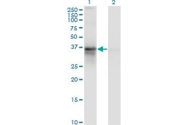 RP2 anticorps  (AA 251-350)