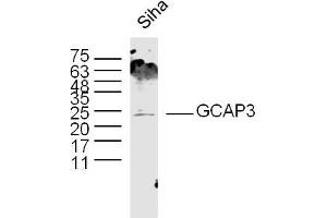 Siha lysates probed with GCAP3 Polyclonal Antibody, Unconjugated  at 1:300 dilution and 4˚C overnight incubation. (GUCA1C Antikörper  (AA 141-209))