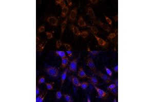 Immunofluorescence analysis of NIH-3T3 cells using VPS25 Polyclonal Antibody (ABIN6128913, ABIN6150122, ABIN6150123 and ABIN6217011) at dilution of 1:100 (40x lens). (VPS25 Antikörper  (AA 1-176))