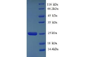 HLA-DQA2 Protein (AA 24-214) (His tag)