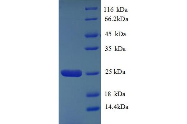 HLA-DQA2 Protein (AA 24-214) (His tag)