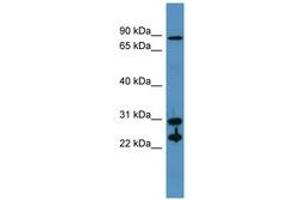 Image no. 1 for anti-Carbonic Anhydrase II (CA2) (AA 73-122) antibody (ABIN6746752) (CA2 Antikörper  (AA 73-122))
