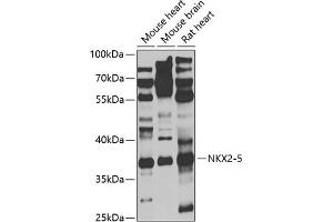 Western blot analysis of extracts of various cell lines, using NKX2-5 antibody (ABIN6132412, ABIN6144644, ABIN6144646 and ABIN6221293) at 1:1000 dilution. (NK2 Homeobox 5 Antikörper  (AA 1-135))