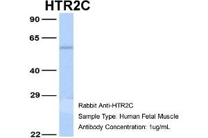 Western Blotting (WB) image for anti-5-Hydroxytryptamine (serotonin) Receptor 2C (HTR2C) (N-Term) antibody (ABIN2792274)