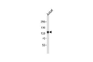 MER Antibody (ABIN392343 and ABIN2841983) western blot analysis in Jurkat cell line lysates (35 μg/lane). (MERTK Antikörper)