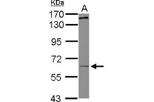 Western Blotting (WB) image for anti-Kinesin Family Member 19 (KIF19) (AA 88-344) antibody (ABIN1499036) (KIF19 Antikörper  (AA 88-344))