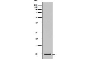 Western blot analysis of Calreticulin expression in IGF1 recombinant protein.