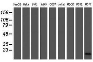 Image no. 2 for anti-Cellular Retinoic Acid Binding Protein 2 (CRABP2) antibody (ABIN1497621) (CRABP2 Antikörper)
