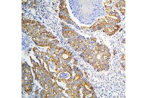 IHC analysis of DARS2 using anti-DARS2 antibody (ABIN6719279). (DARS2 Antikörper  (AA 334-448))