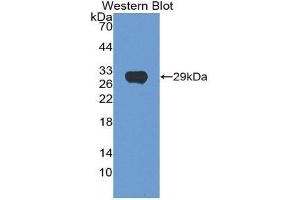 Western Blotting (WB) image for anti-Hexosaminidase A (HEXA) (AA 318-529) antibody (ABIN1862597) (Hexosaminidase A Antikörper  (AA 318-529))