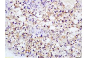 Formalin-fixed and paraffin embedded mouse placenta labeled with Rabbit Anti-Endothelial Lipase Polyclonal Antibody, Unconjugated  at 1:200 followed by conjugation to the secondary antibody and DAB staining (LIPG Antikörper  (AA 1-500))