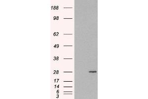 HEK293 overexpressing RAB11A(ABIN5362200) and probed with ABIN184807 (mock transfection in first lane). (RAB11A Antikörper  (C-Term))