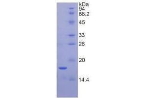 SDS-PAGE analysis of Human Periostin Protein. (Periostin Protein (POSTN))