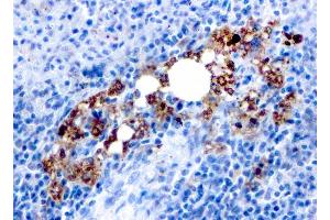 Formalin-fixed, paraffin-embedded human Spleen stained with TRAcP Mouse Recombinant Monoclonal Antibody (rACP5/1070). (Rekombinanter ACP5 Antikörper)