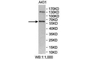 Western Blotting (WB) image for anti-Makorin Ring Finger Protein 3 (MKRN3) antibody (ABIN1855943) (MKRN3 Antikörper)
