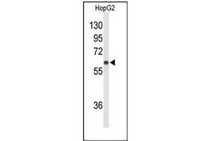 Western blot analysis of  SLCO1B1 / OATP2 Antibody (Center) Cat. (SLCO1B1 Antikörper  (Middle Region))