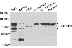 Western blot analysis of extracts of various cell lines, using UGT2B10 antibody. (UGT2B10 Antikörper)