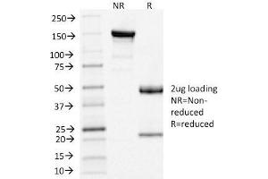 SDS-PAGE Analysis of Purified Clathrin, LC Mouse Monoclonal Antibody (CLC/1421). (CLTA/CLTB Antikörper  (N-Term))
