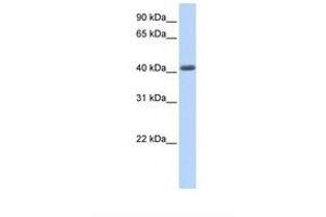 Image no. 1 for anti-Leucine Rich Repeat Containing 2 (LRRC2) (N-Term) antibody (ABIN6738040) (LRRC2 Antikörper  (N-Term))